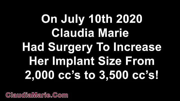 Claudia Marie New 3,500 cc Implants!